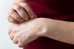 Side effects of Gastritis antibiotics